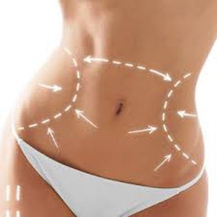plastie abdominale